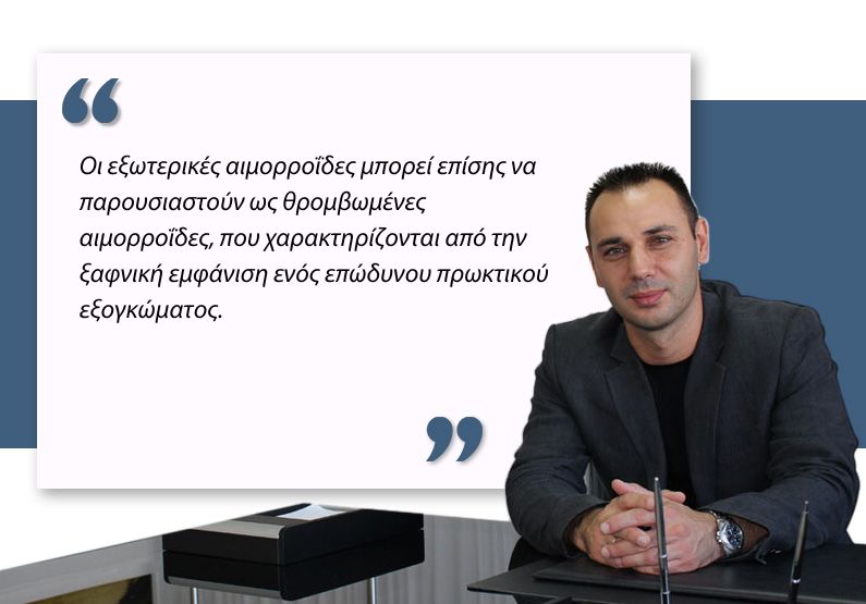 Εξωτερικές αιμορροΐδες
