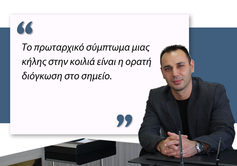 Κήλη στην κοιλιά
