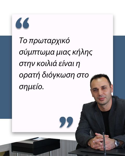 Κήλη στην κοιλιά