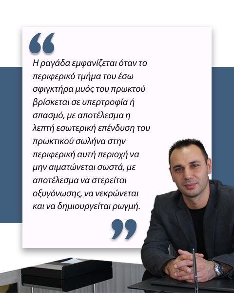 Ραγάδα δακτυλίου